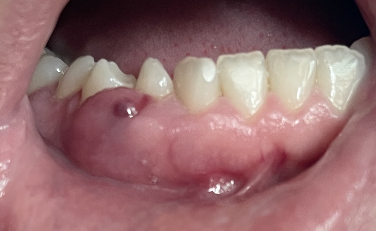 Aspen Dental - Southern Pines photo 3