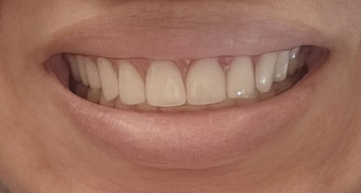 Affordable Dentures & Implants - Bullhead City photo 5