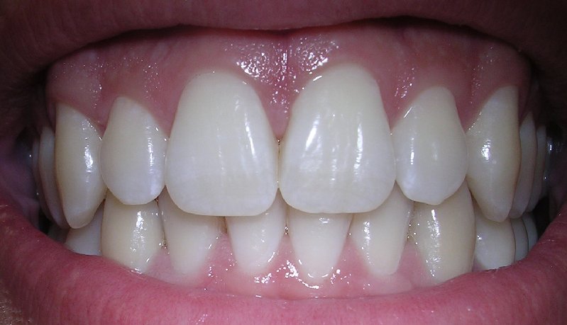 Lehigh Valley Sculpted Smiles: Michael E. Kun, DMD photo 1