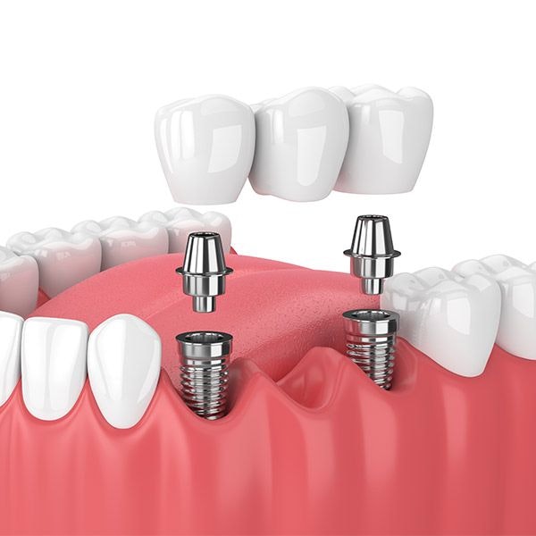 Ryan K. Austin, DDS Oral and Maxillofacial Surgery photo 3