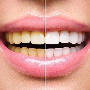 Nickles Dental Oral Surgery and Family Dentistry photo 2