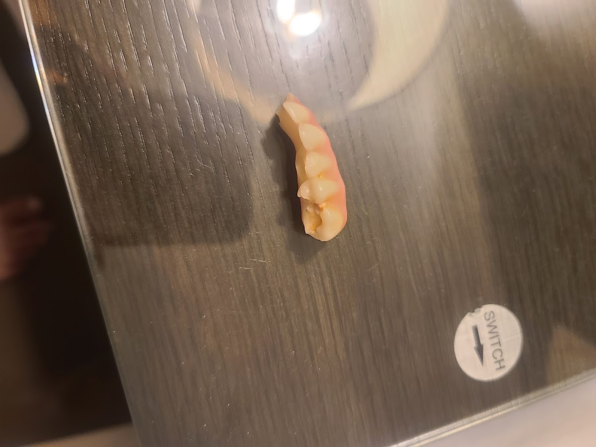 Cleveland Dentures and Implants photo 2