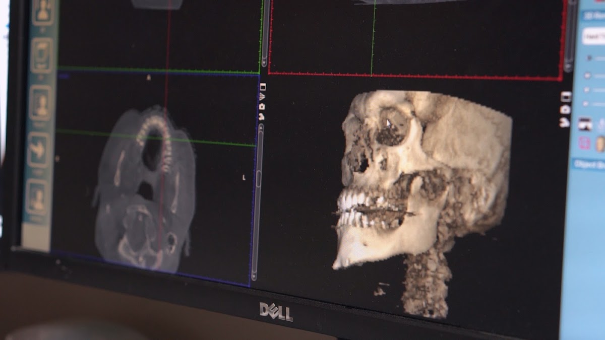 Oral and Maxillofacial Associates photo 4