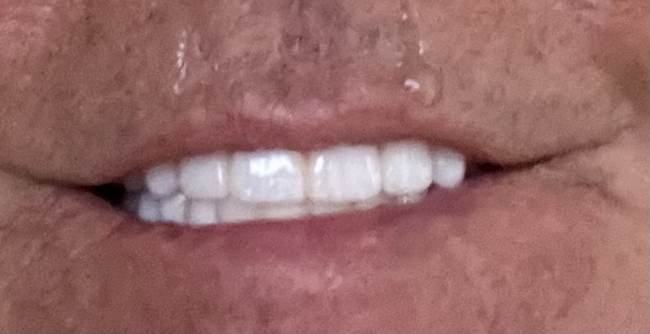 Affordable Dentures & Implants - Leesburg photo 5