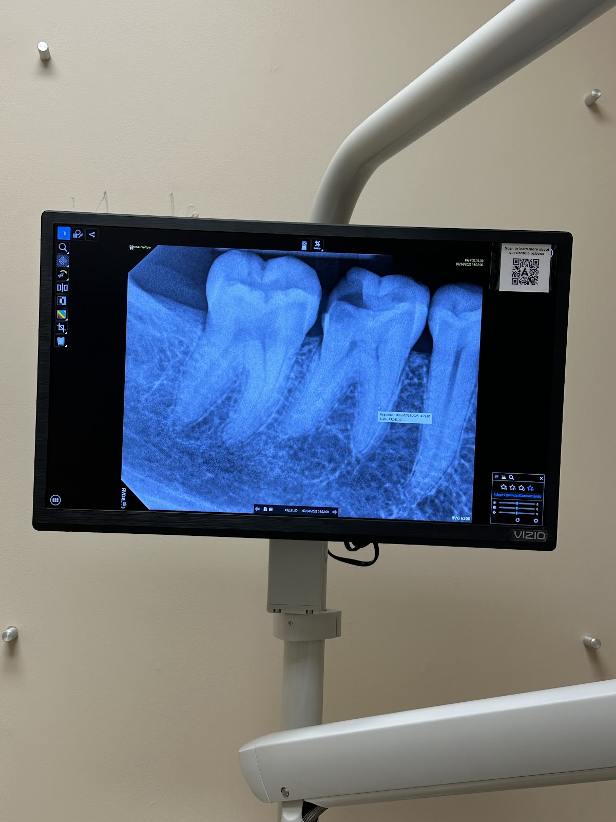 Aspen Dental - Valparaiso photo 4