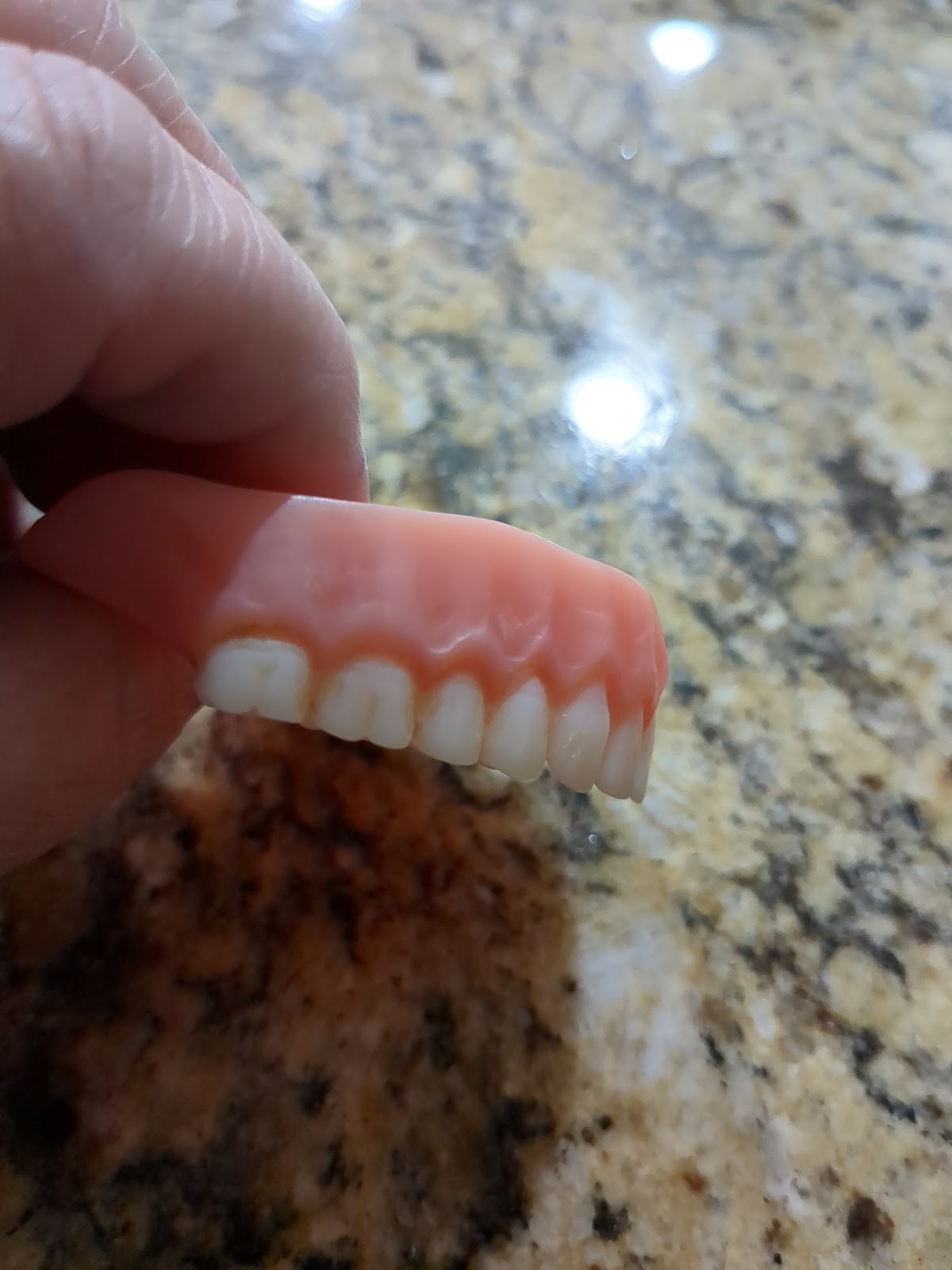 Aspen Dental - Shelby photo 1