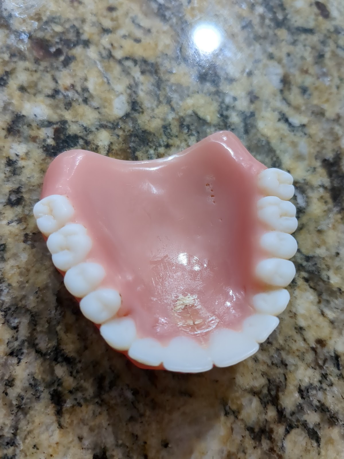Aspen Dental - Shelby photo 5