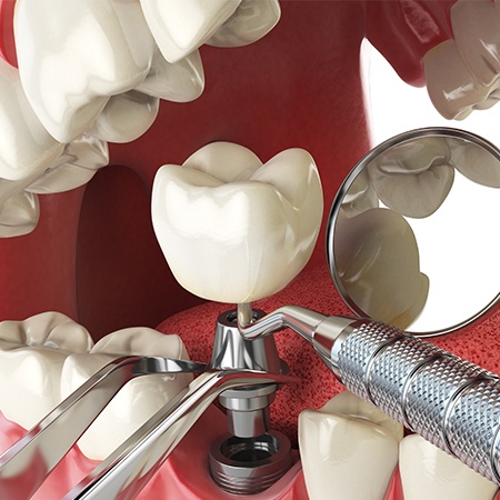 Memphis Oral and Maxillofacial Surgery Group photo 3