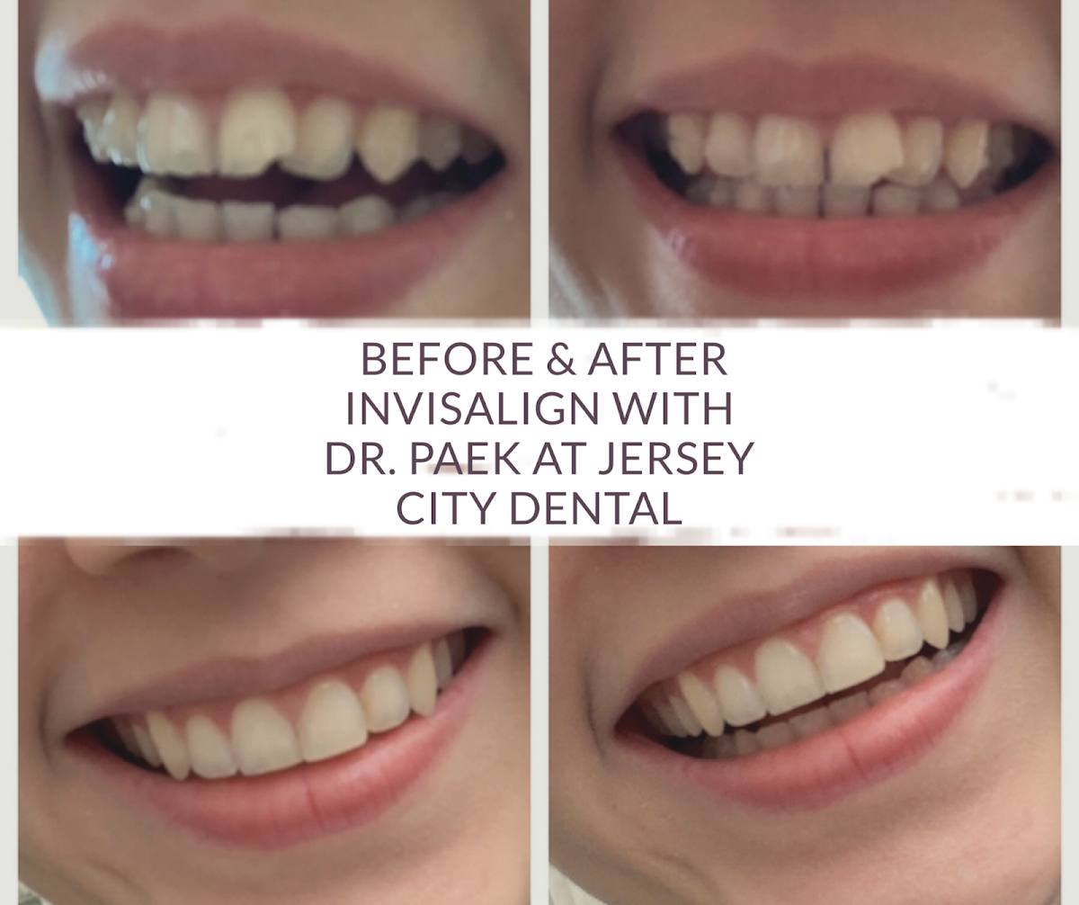 Midtown Dental Group Jersey City photo 4