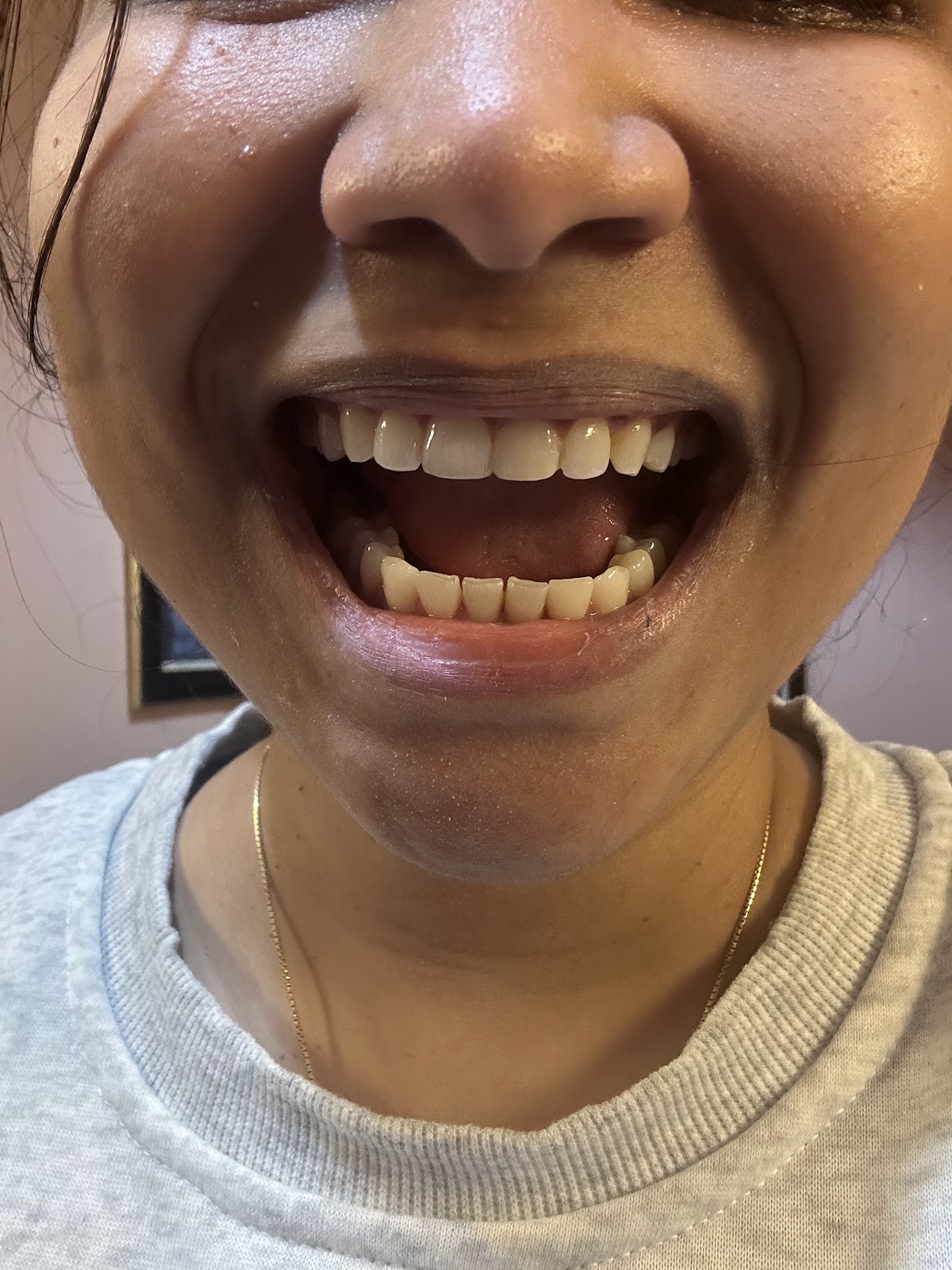 Midtown Dental Group Jersey City photo 6
