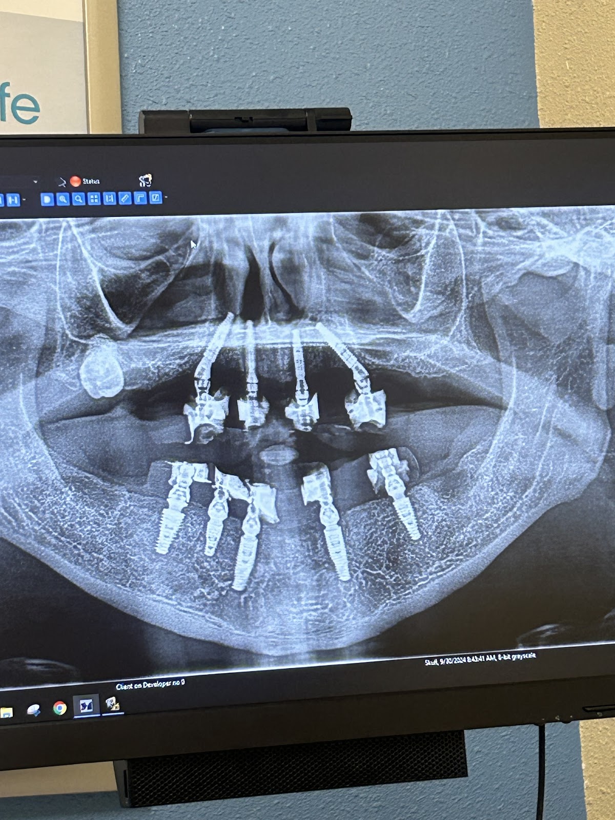 Affordable Dentures & Implants - Clinton photo 5