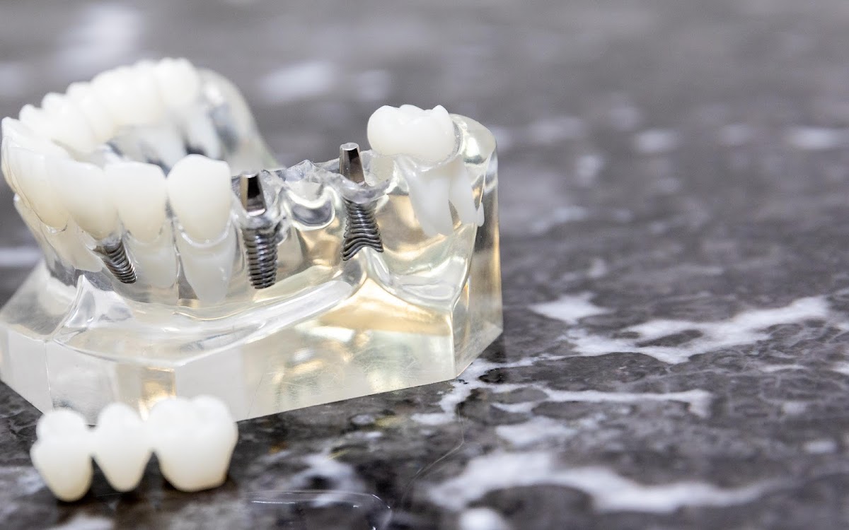 Texas Center For Oral Surgery & Dental Implants photo 3