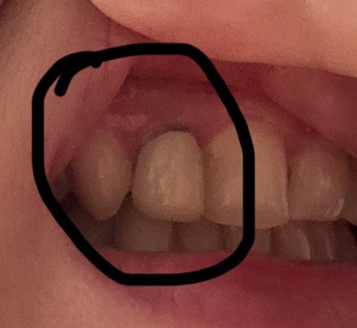 Tompkins Dental in Ithaca photo 4