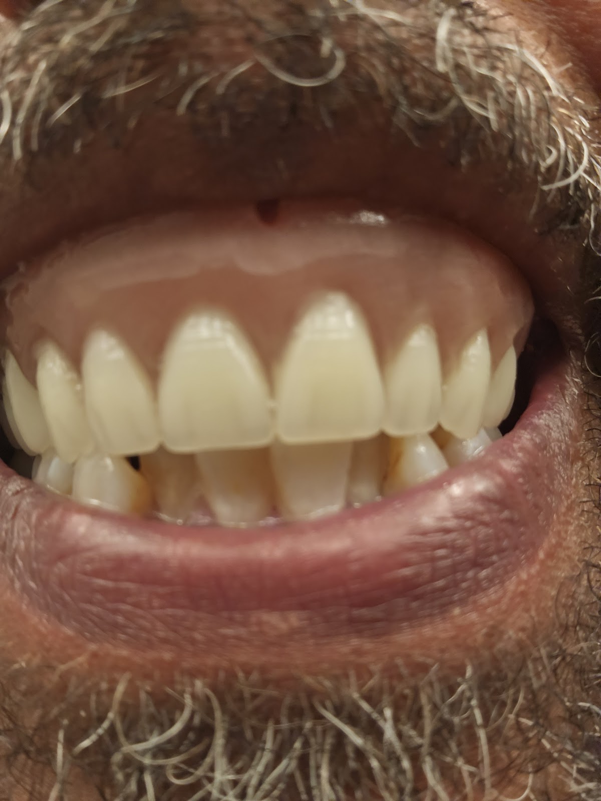 Affordable Dentures & Implants - Newnan photo 3