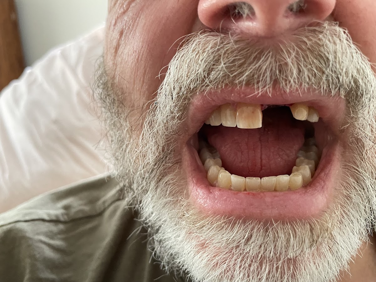 Mid-missouri Wisdom Teeth and Implants photo 5