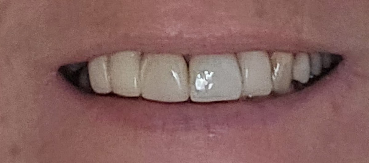 Bright Star Dental Llc photo 1