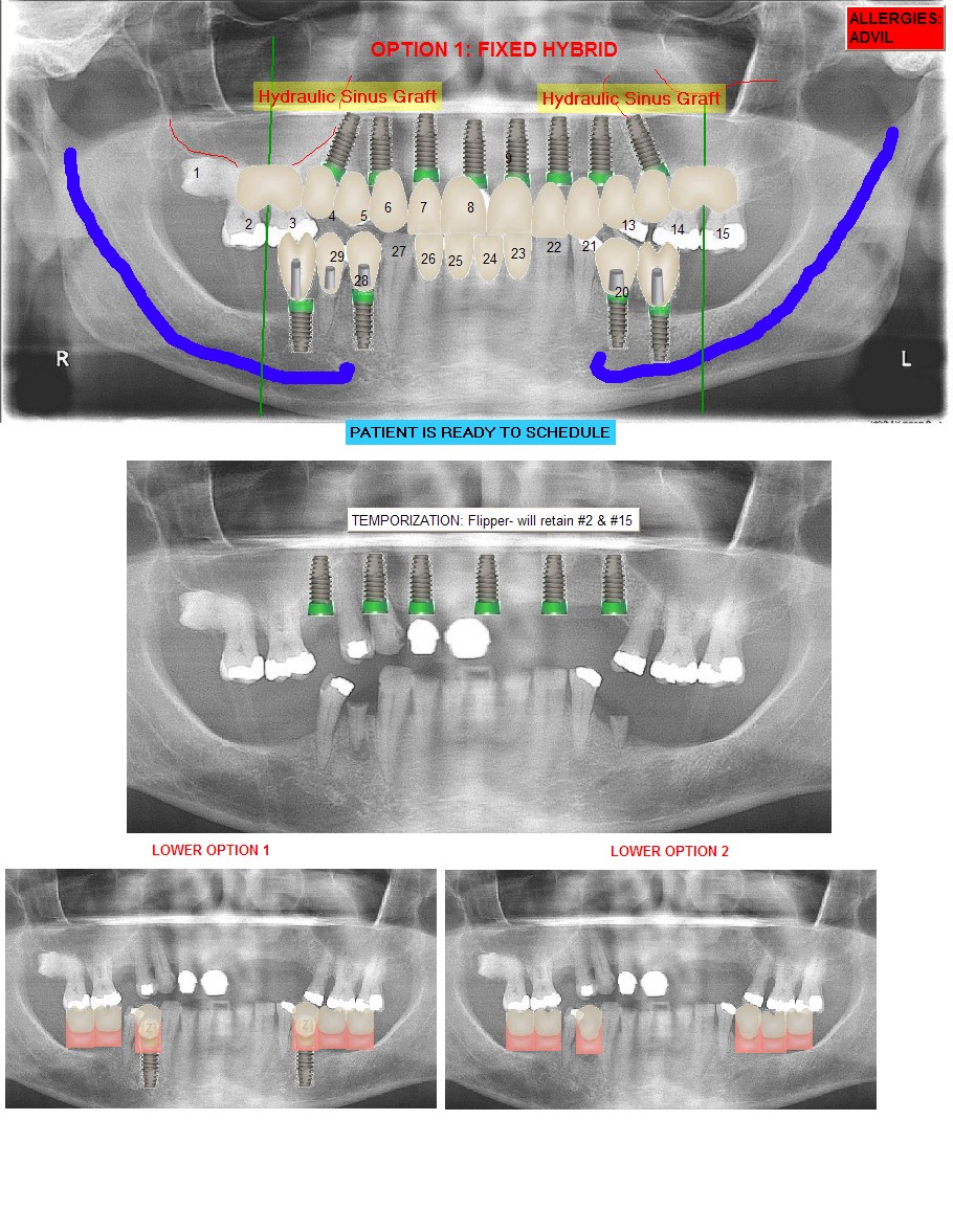 Sarasota Implant photo 2