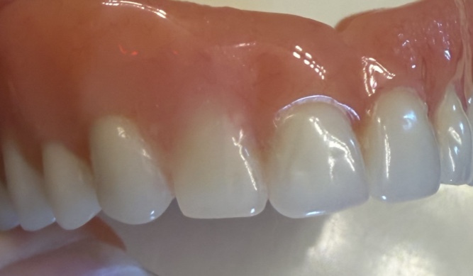 Affordable Dentures & Implants - Paducah photo 3