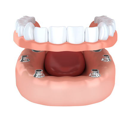 Optimum Oral Surgery & Dental Implants photo 1