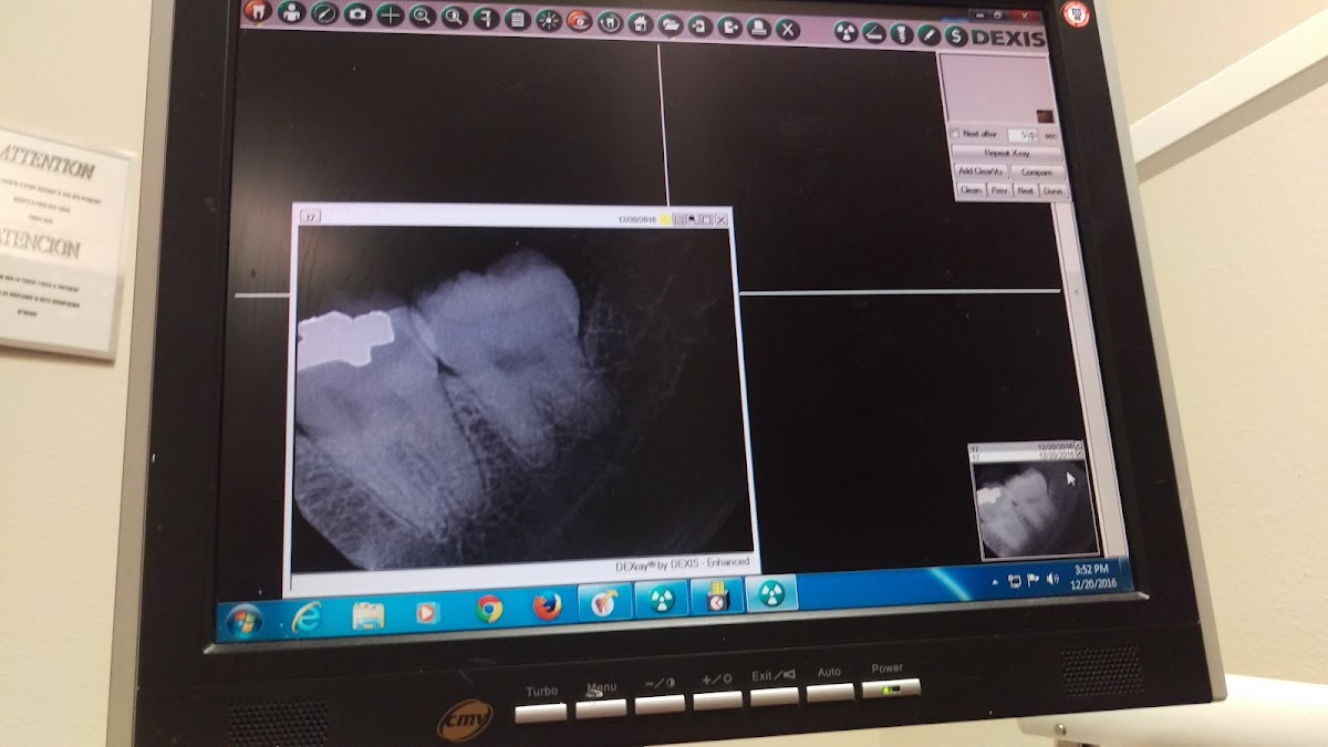 Upland Dental Implant And Orthodontics photo 6