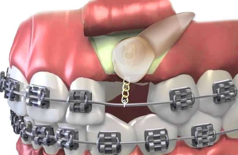 Valley Dental photo 5
