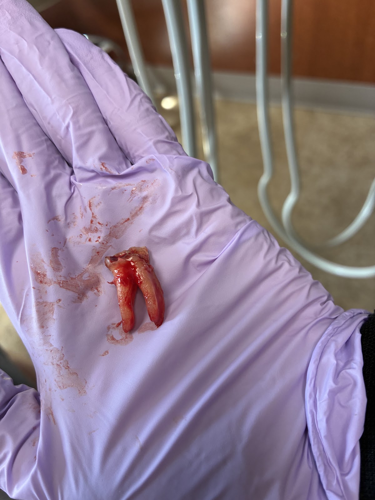 Aspen Dental - Port Richey photo 5