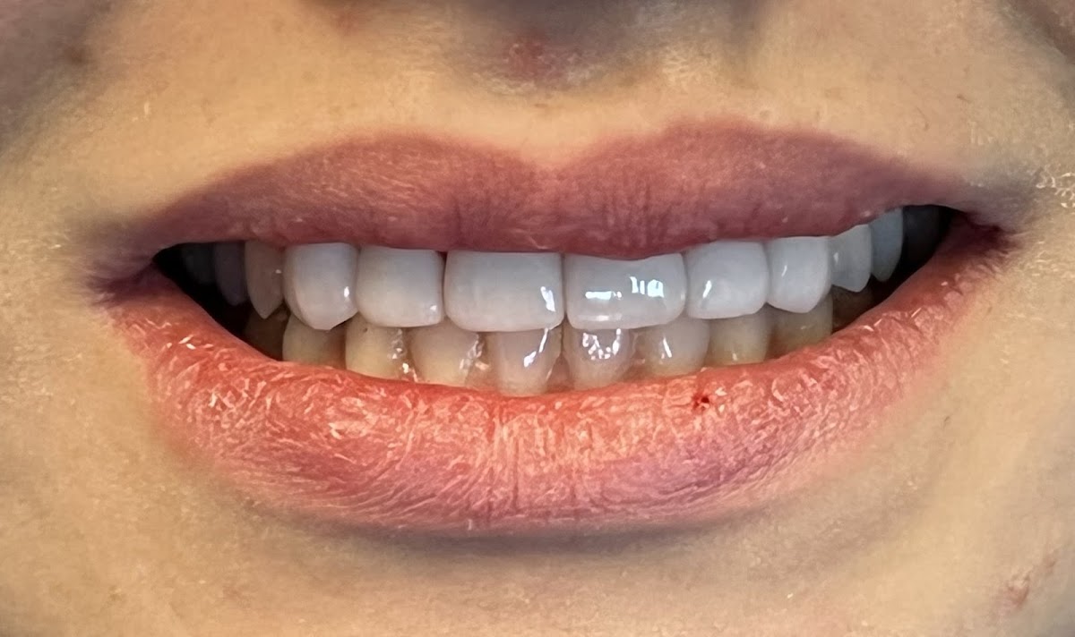 Modesto Dentistry and Implants photo 6