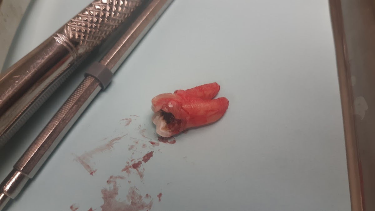 Aspen Dental - Adrian photo 3