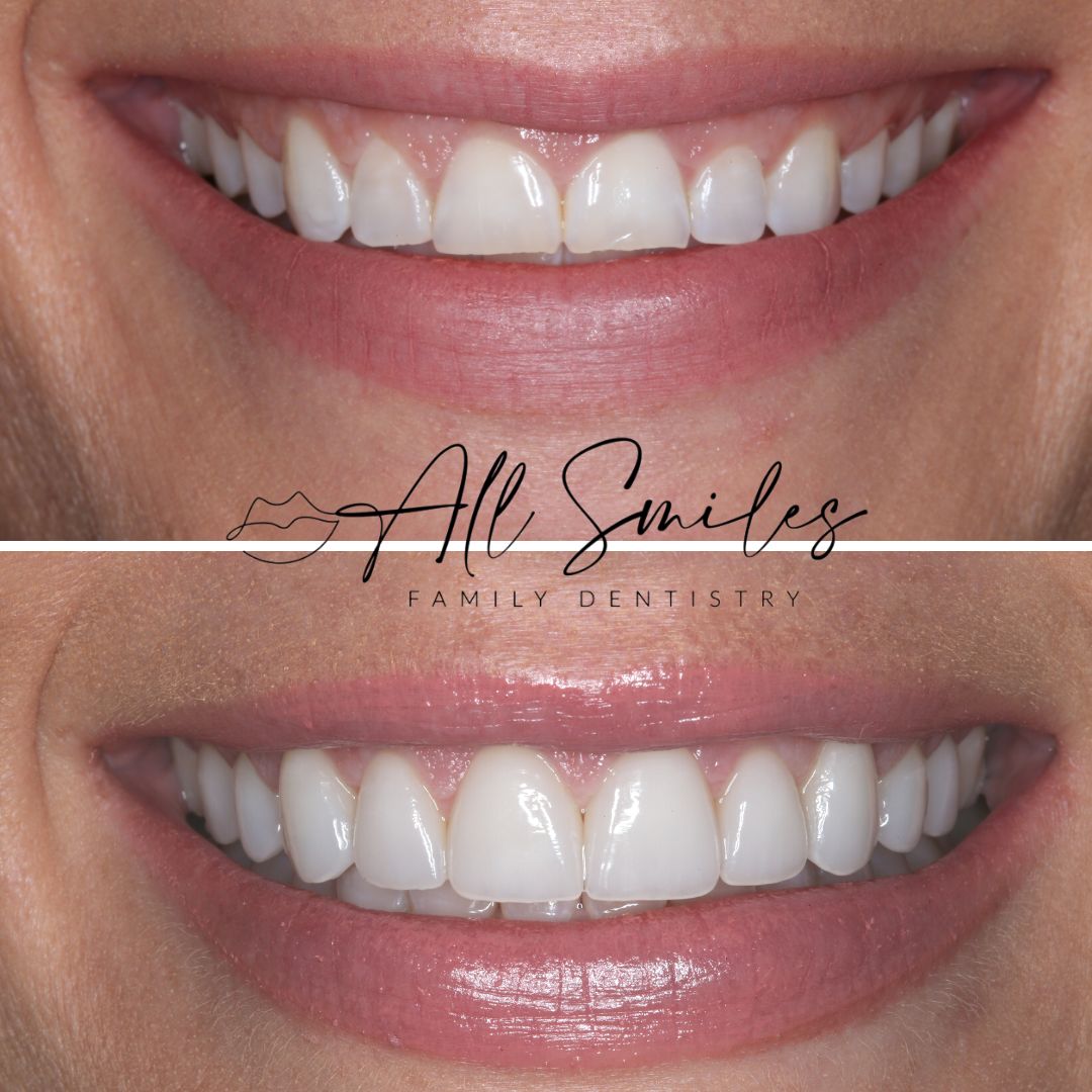 All Smiles Family Dentistry photo 2