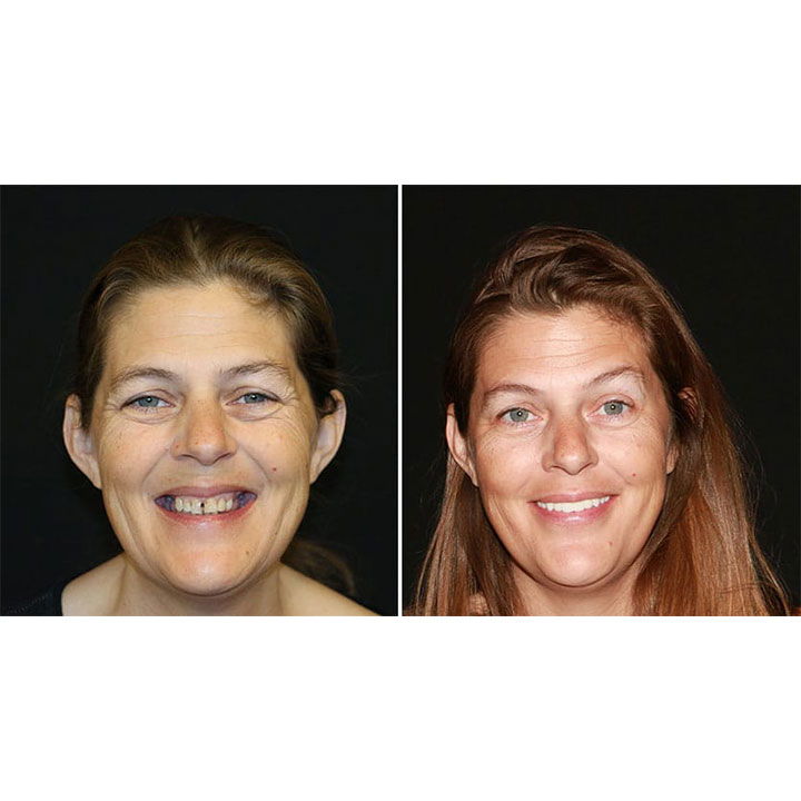 Smileonimplants Dental Centers photo 4