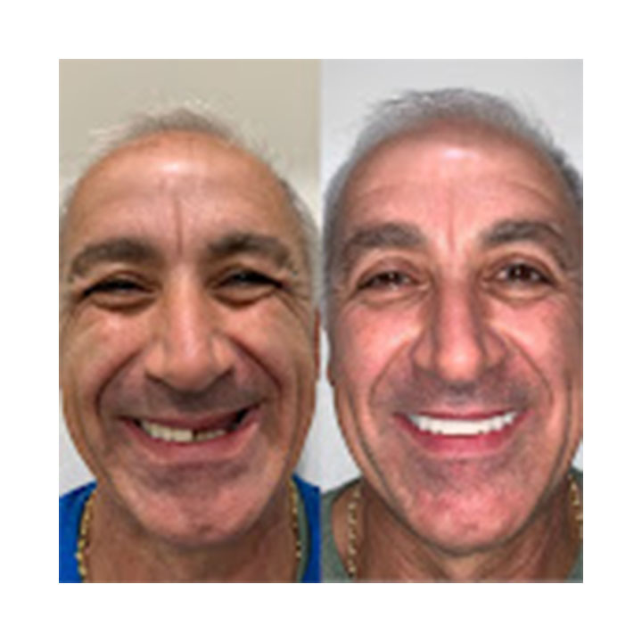 Smileonimplants Dental Centers photo 5
