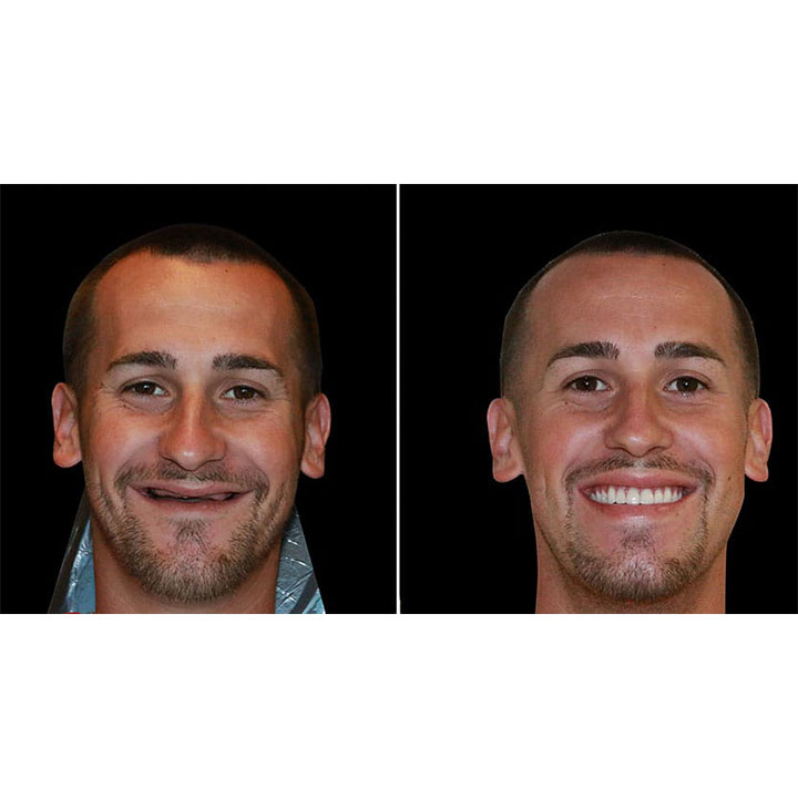 Smileonimplants Dental Centers photo 6