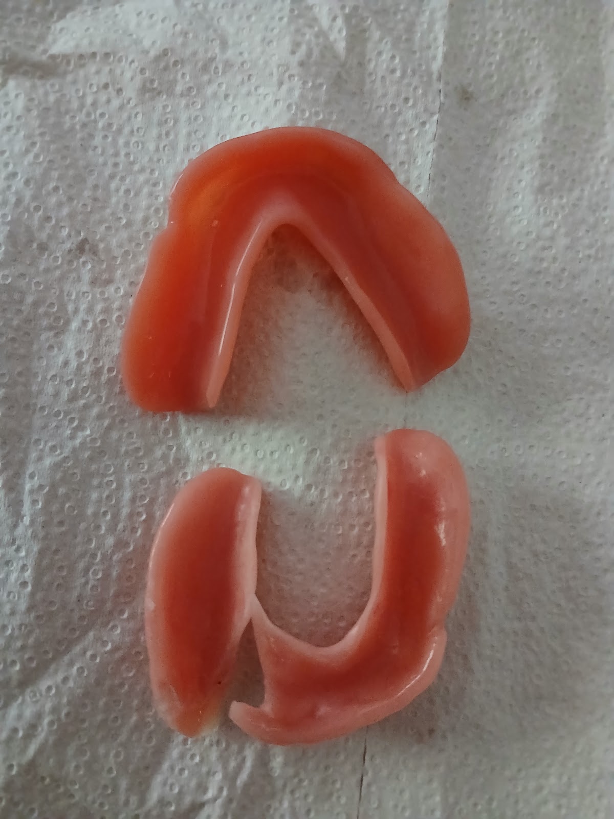 Aspen Dental - Tuscaloosa photo 3