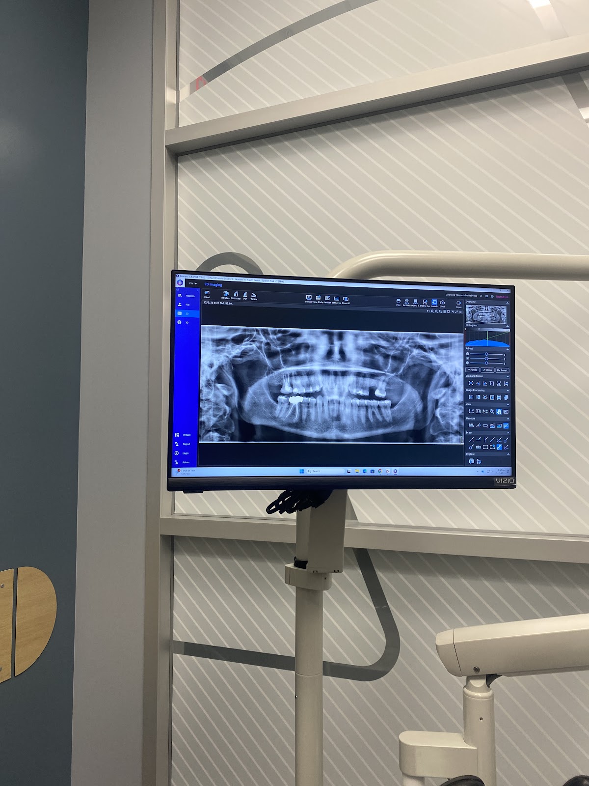 Aspen Dental - Spanish Fork photo 5