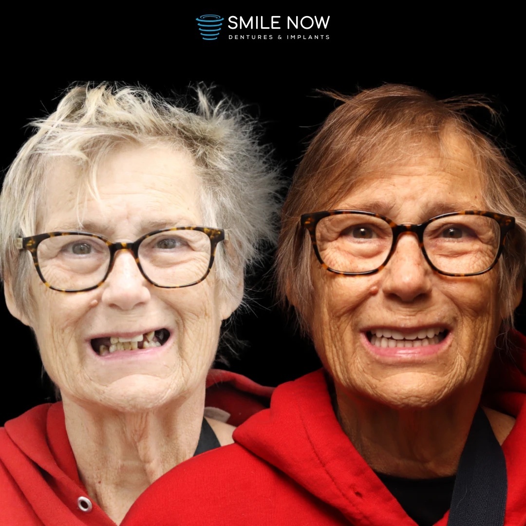 Smile Now Reno Dentures and Implants photo 4
