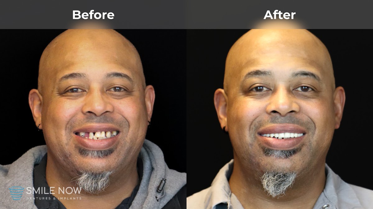 Smile Now Reno Dentures and Implants photo 6