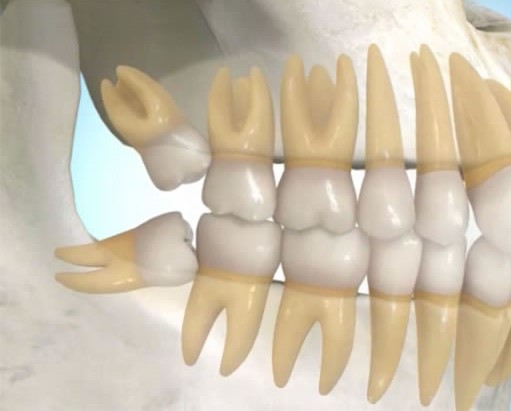 Kerrville Oral & Maxillofacial Surgery, Dr. James Lussier photo 1