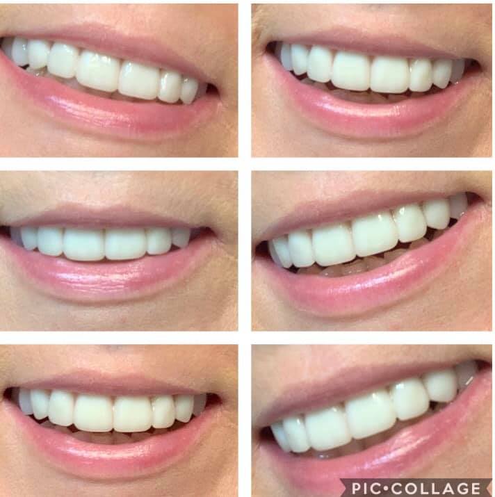 Locke Family Dentistry photo 3
