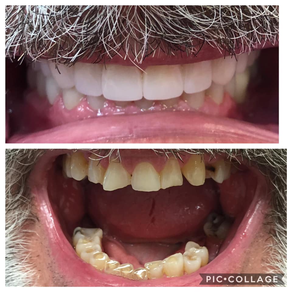 Locke Family Dentistry photo 5