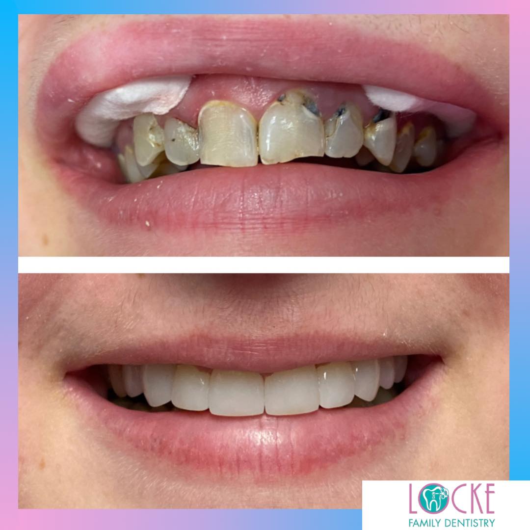 Locke Family Dentistry photo 6