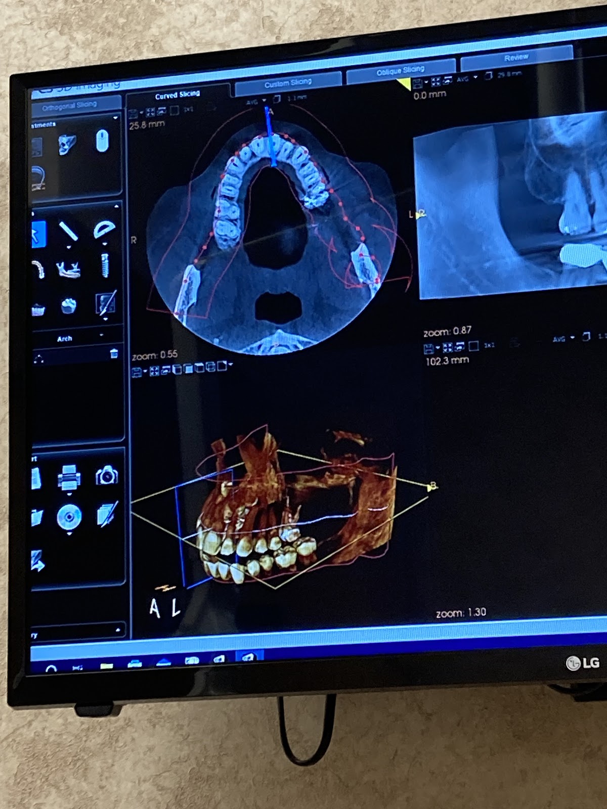New Jersey Oral & Maxillofacial Surgery photo 6