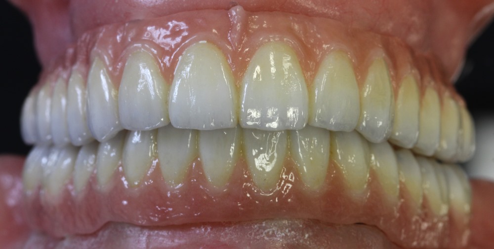 Great State Dental Lab photo 1