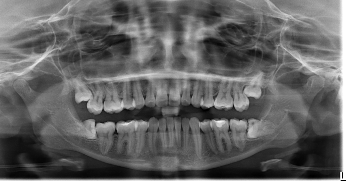 The International Center for Tmj and Jaw Surgery - Dr. Moe Hakim - Oral Surgeon photo 2
