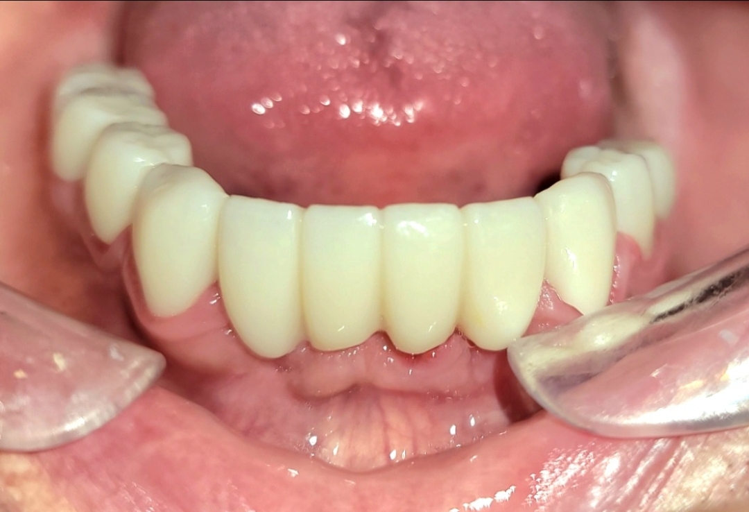Long Falls Dentistry photo 5