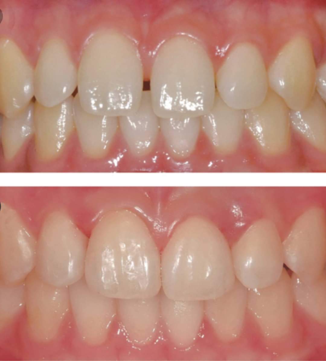 Long Falls Dentistry photo 6