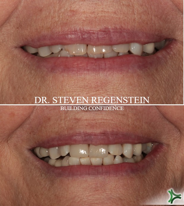 Esthetic Dental Group of Westport: Dr. Steven Regenstein photo 6