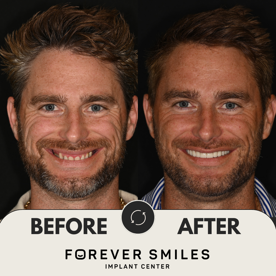 Forever Smiles Implant Center photo 1