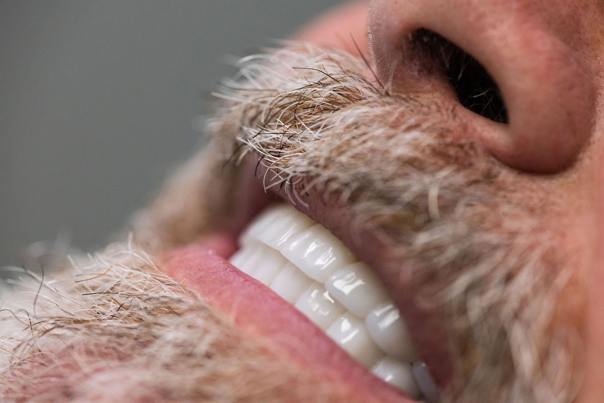 Forever Smiles Implant Center photo 4