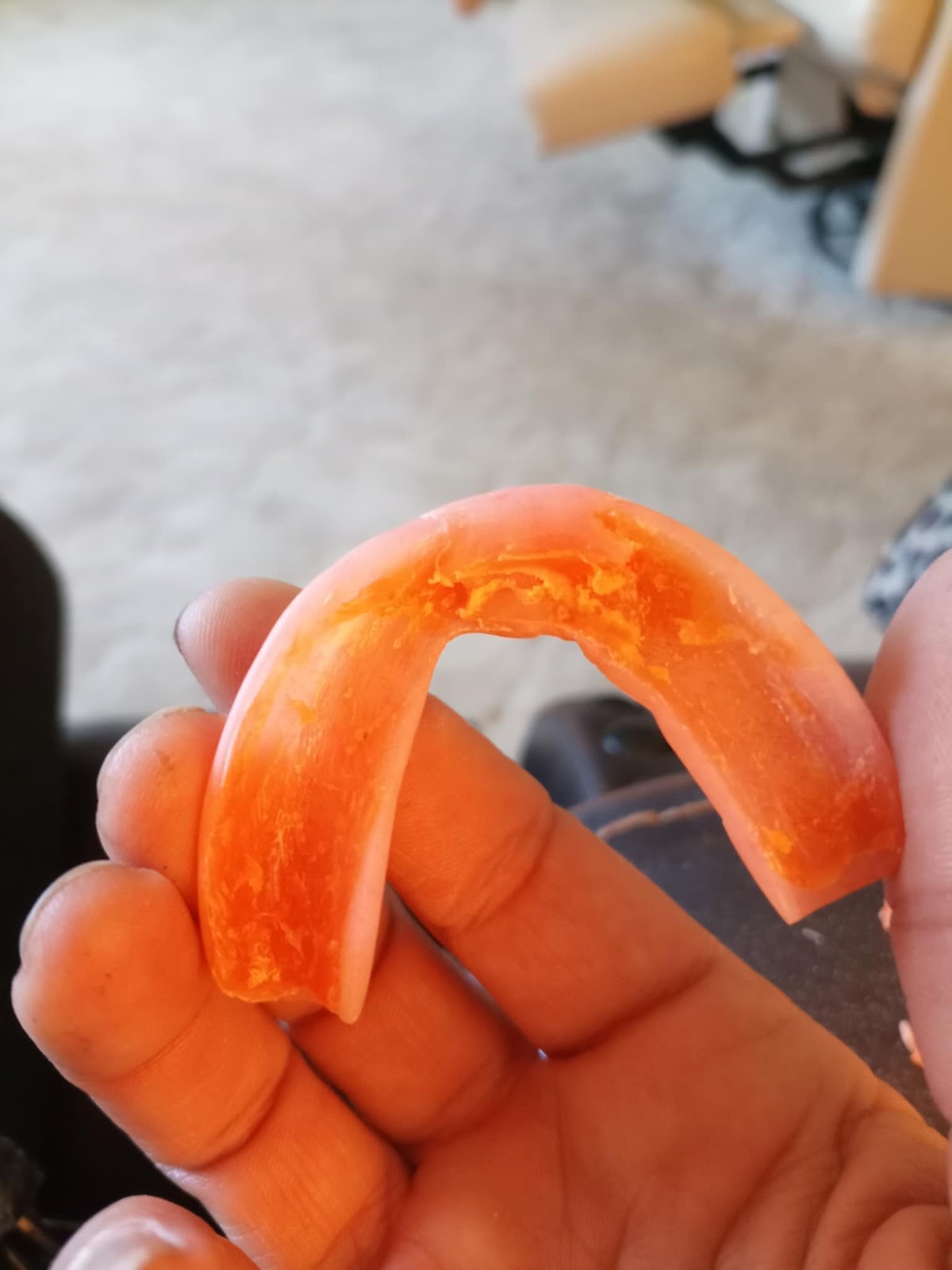 Affordable Dentures & Implants - Harker Heights photo 6