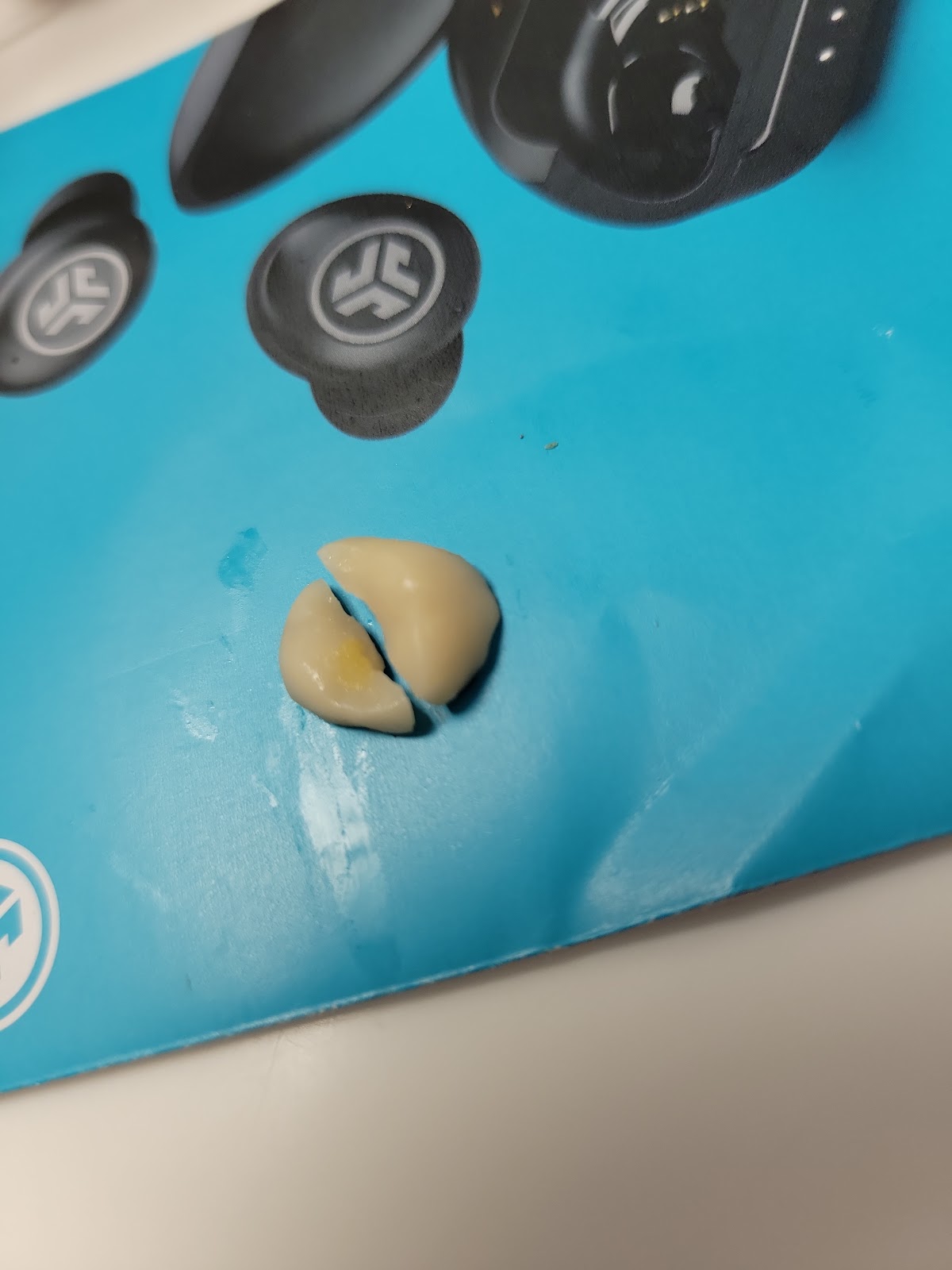 Aspen Dental - Saugus photo 3